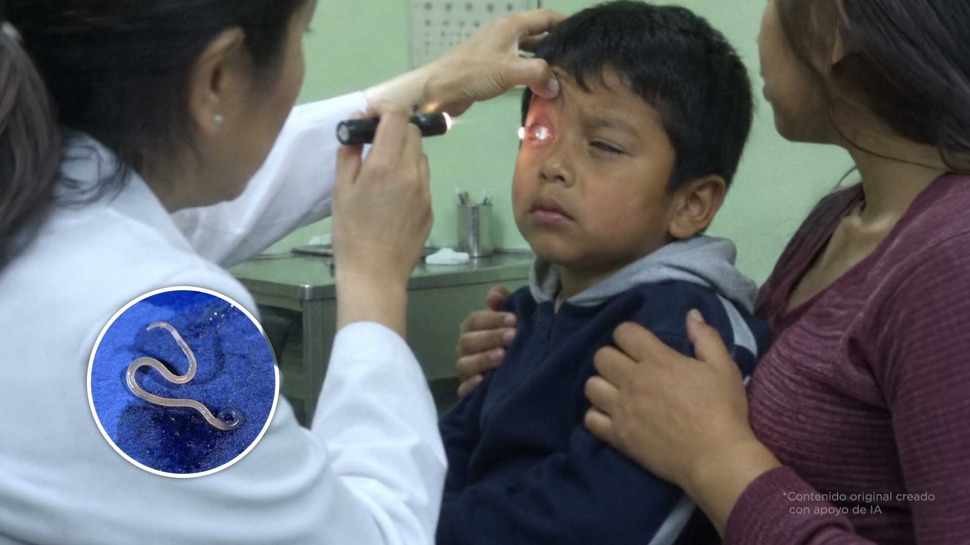 Las lombrices de tu perro pueden dejar ciego a tu hijo. Esto tienes que hacer